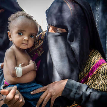 yemen child hungry